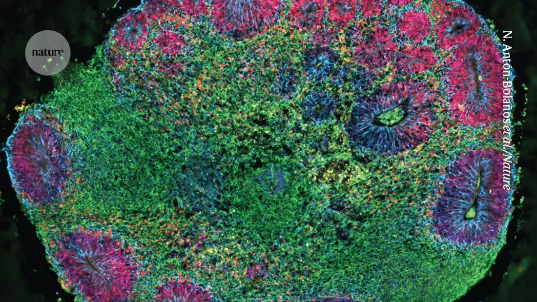 Forscher haben erstmals 3D-Modelle des Gehirns entwickelt, die eine Vielzahl von Zelltypen aus mehreren Personen enthalten. Diese "Dorf-im-Modell" Organoiden könnten dazu beitragen, warum die Gehirnreaktion auf Medikamente von Person zu Person unterschiedlich ist, zu enthüllen.