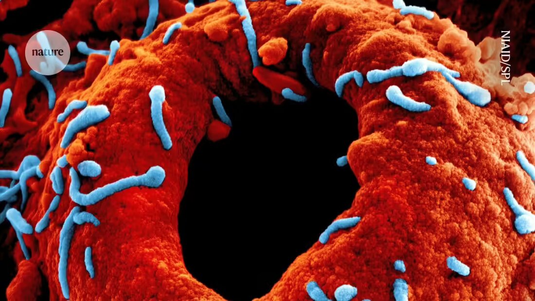 Wissenschaftler testen dringend Impfungen gegen das tödliche Marburg-Virus in Ruanda, wo bereits 27 Fälle und 9 Todesfälle gemeldet wurden.