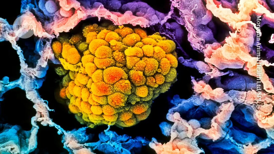 Wenn Sie sich jemals gefragt haben, welchen Einfluss das Älterwerden auf das Risiko von Lungenkrebs haben könnte, sollten Sie diesen Artikel nicht verpassen. Zwei neue Studien an Mäusen deuten darauf hin, dass das Risiko für Lungenkrebs bei Oktogenariern tatsächlich abnehmen könnte. Erfahren Sie mehr über spezifische Gene, die dieser Entwicklung zugrunde liegen, und die überraschende Verbindung zur Eisenstoffwechsel.