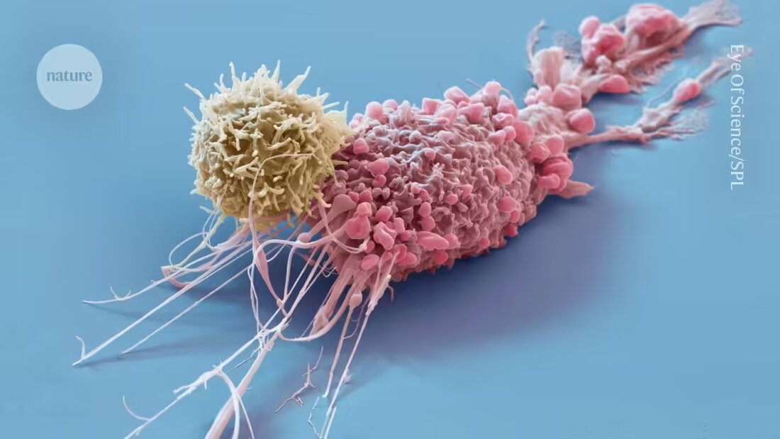 Eine neuartige Therapie mit von Spendern abgeleiteten, CRISPR-modifizierten Immunzellen lässt Autoimmunerkrankungen bei drei Patienten in China schrumpfen.